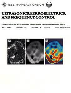 IEEE Transactions on Ultrasonics, Ferroelectrics, and Frequency Control
